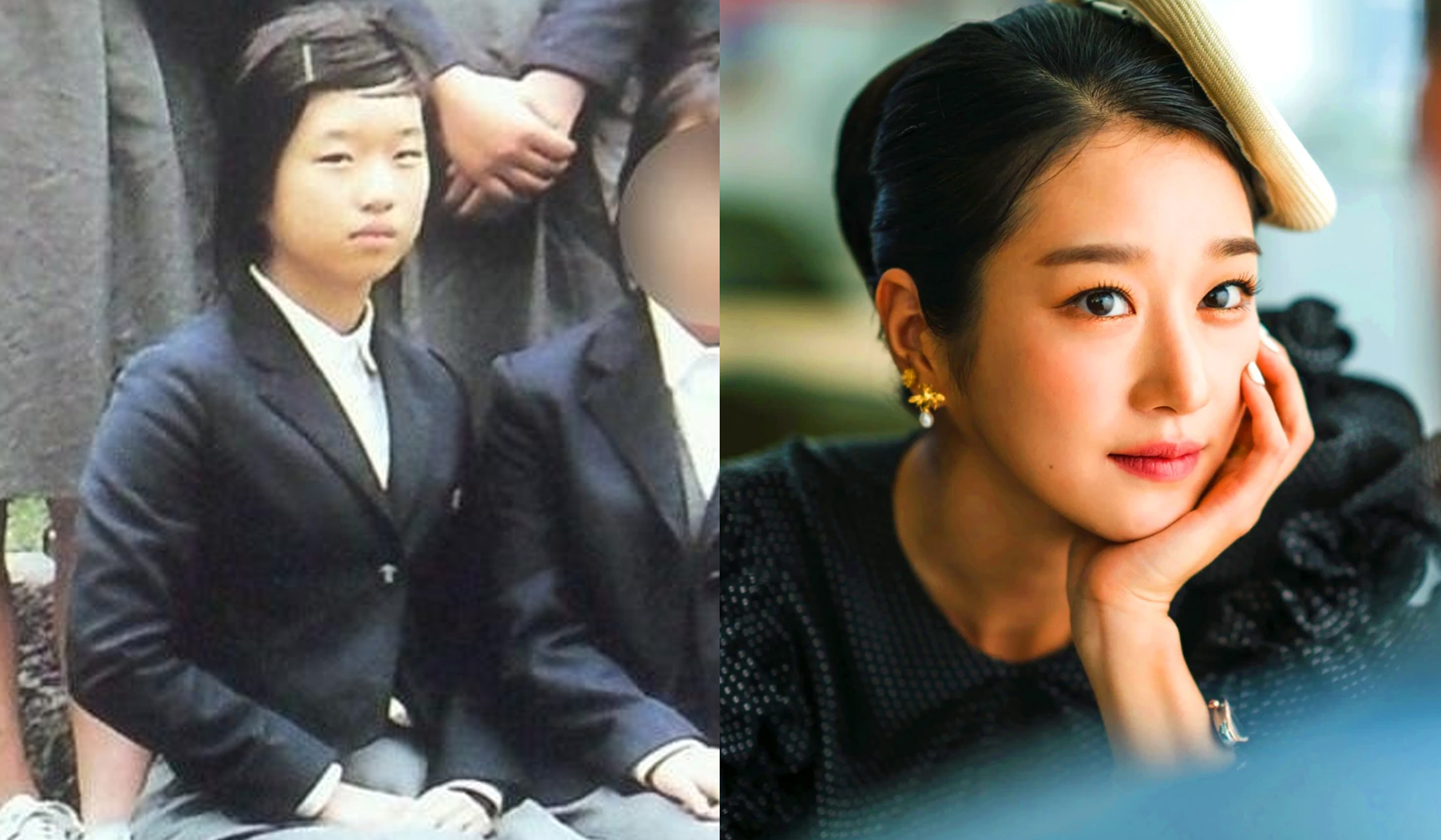 Seo ye ji plastic surgery