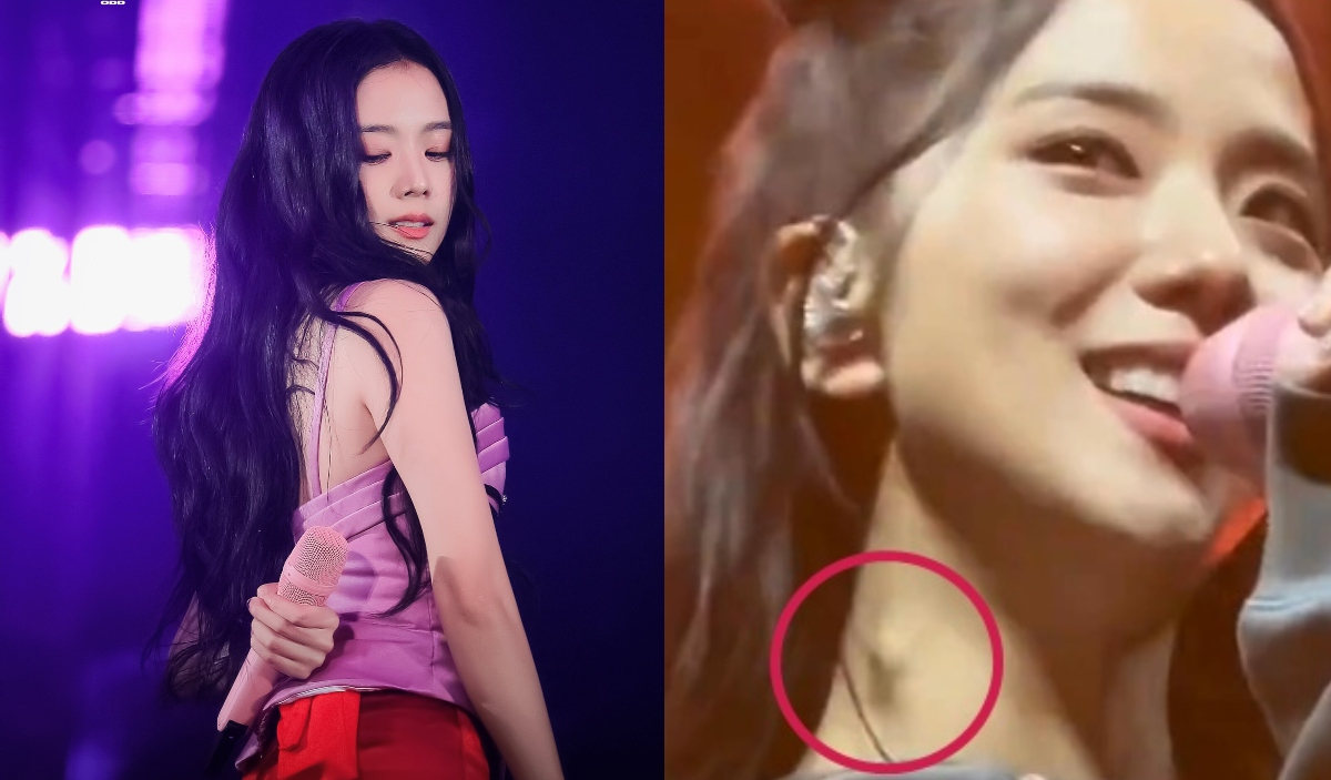 BLACKPINK's Jisoo worries fans when she's spotted with what seems to be ...