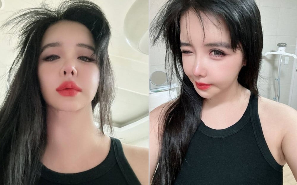 2NE1's Park Bom radiates her slimmer face in new social media update